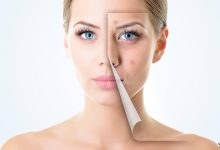 چگونه لکه­های پیری را محو کنیم