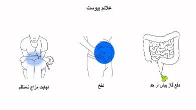علائم یبوست به صورت تصویری