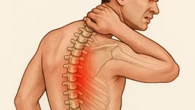 تصویر نیم تنه مردی که در اثر بیماری اسپوندیلیت آنکیلوزان دچار درد و تغییر انحنای ستون فقرات است